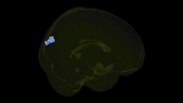 Full Brain Black
