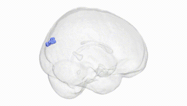 Full Brain White
