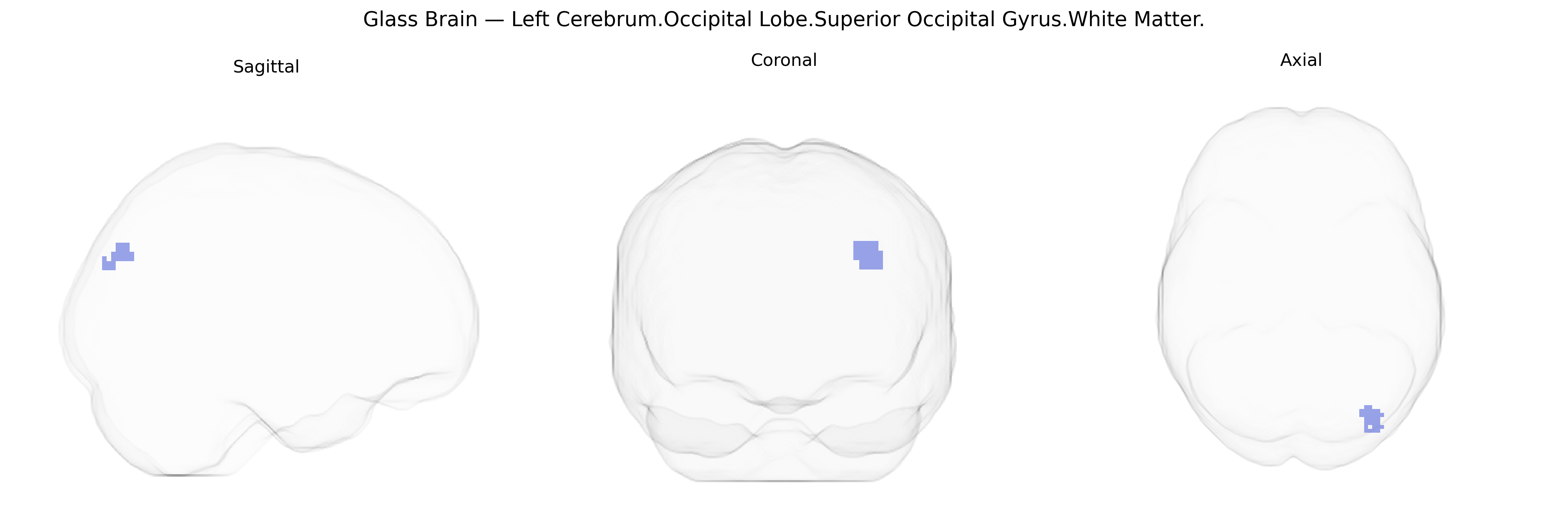 Triplanar Ghost Brain