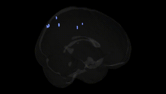 Full Brain Black