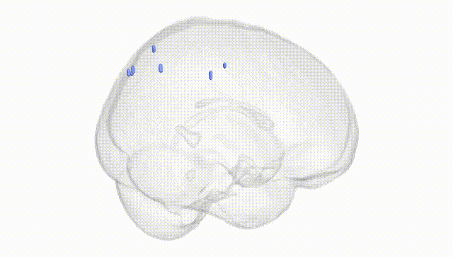 Full Brain White