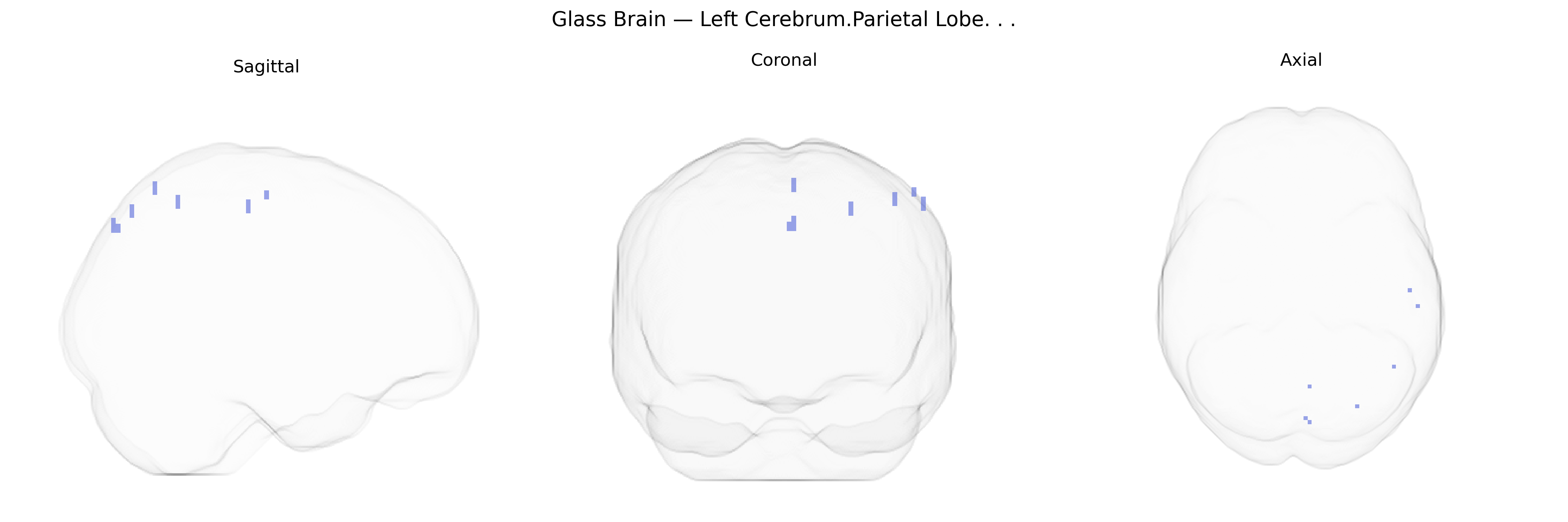 Triplanar Ghost Brain