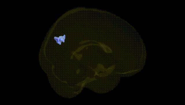 Full Brain Black