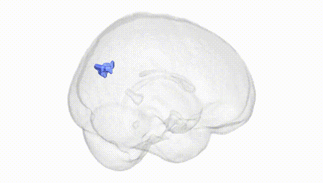 Full Brain White