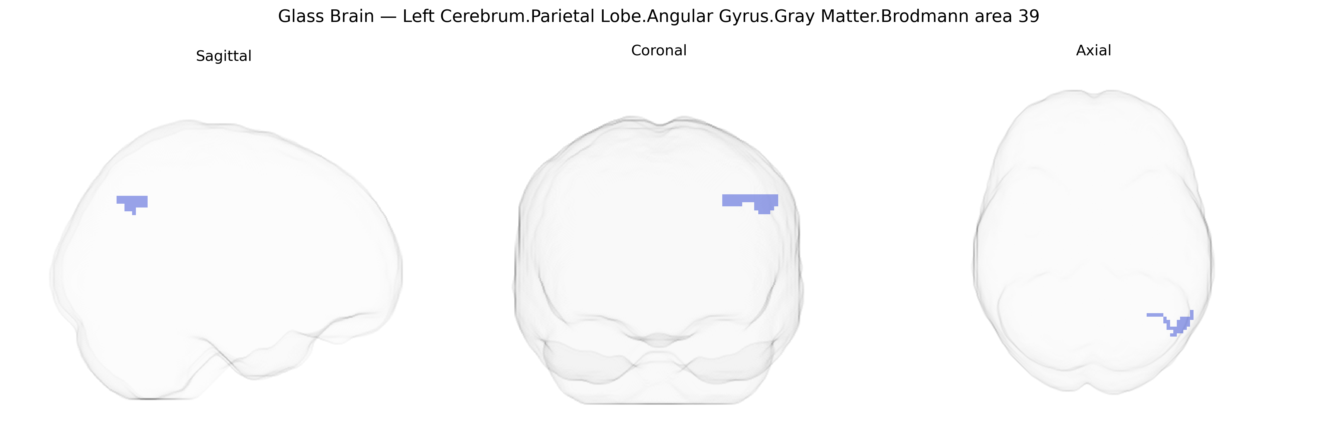 Triplanar Ghost Brain