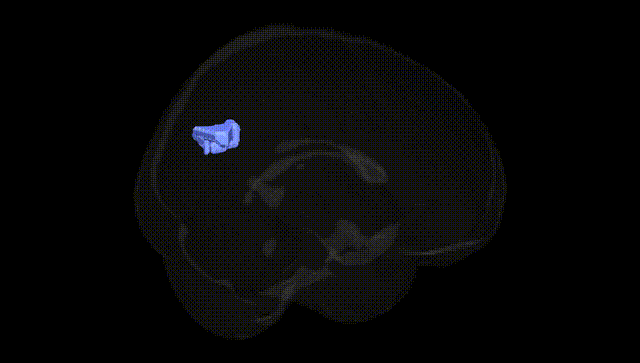 Full Brain Black