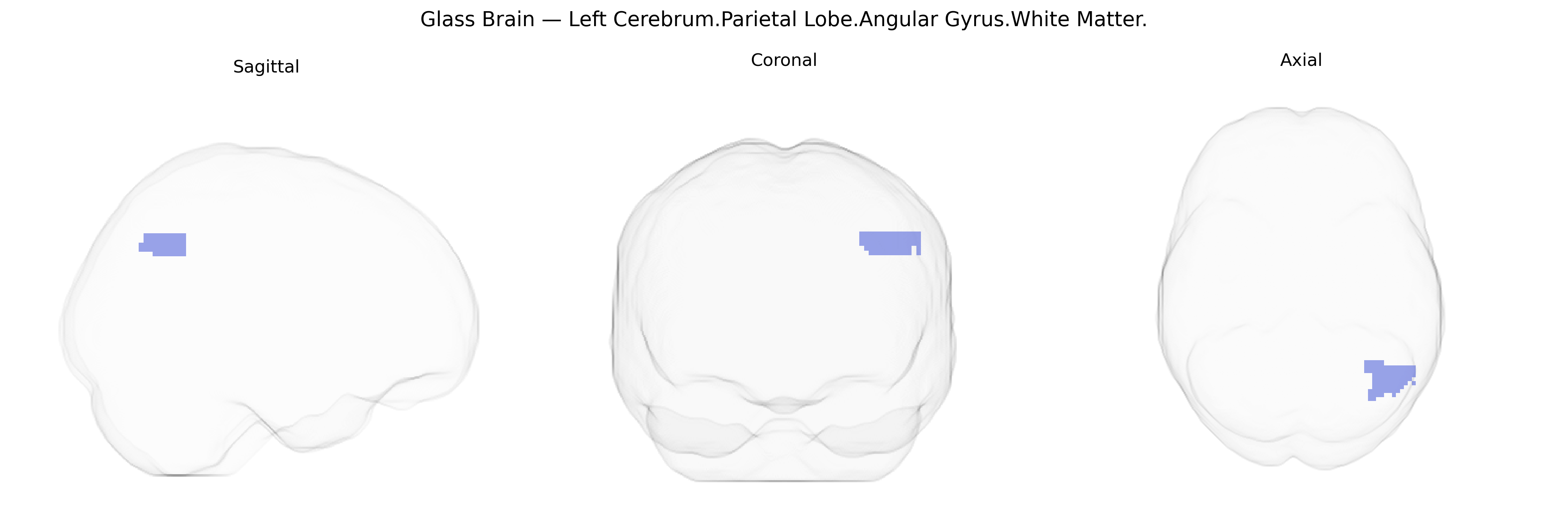 Triplanar Ghost Brain