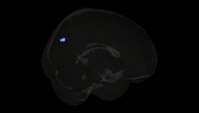 Full Brain Black