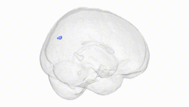 Full Brain White