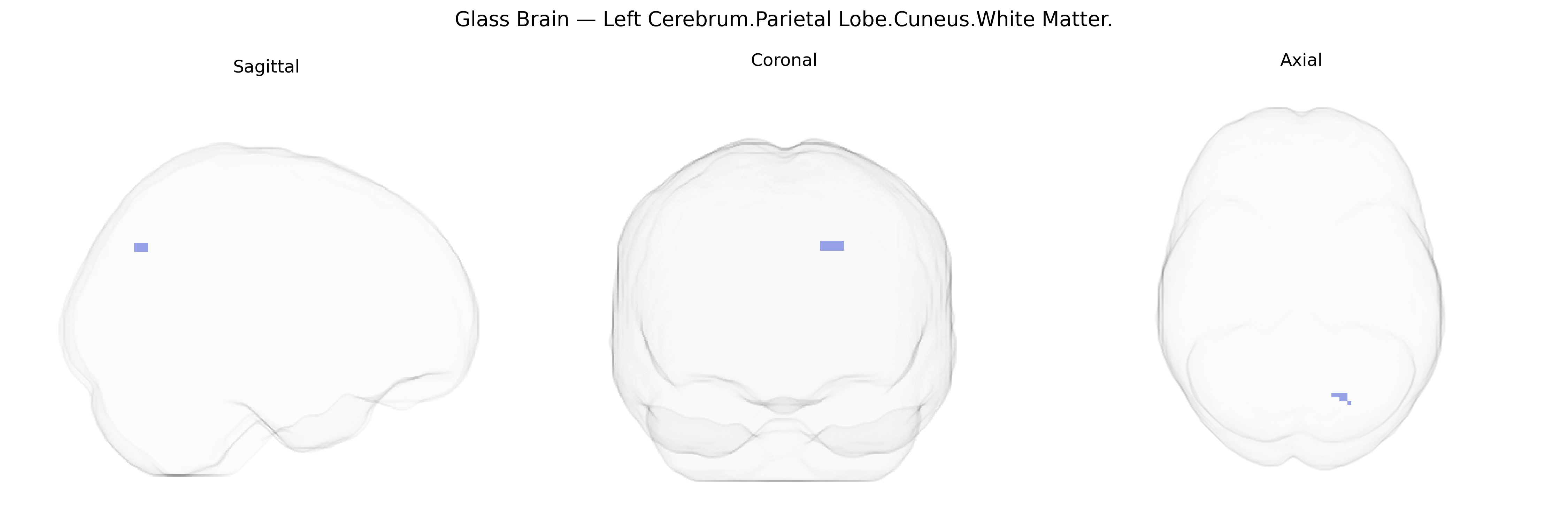 Triplanar Ghost Brain