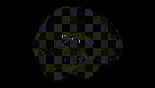 Full Brain Black