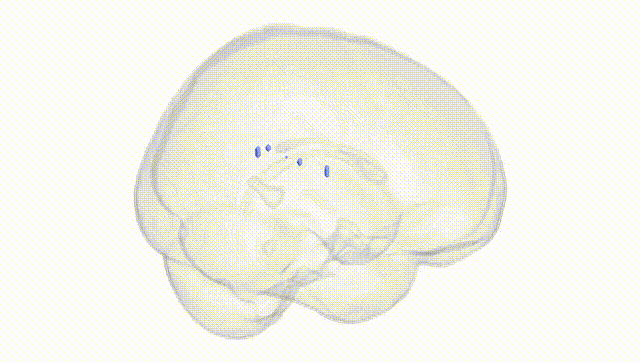 Full Brain White