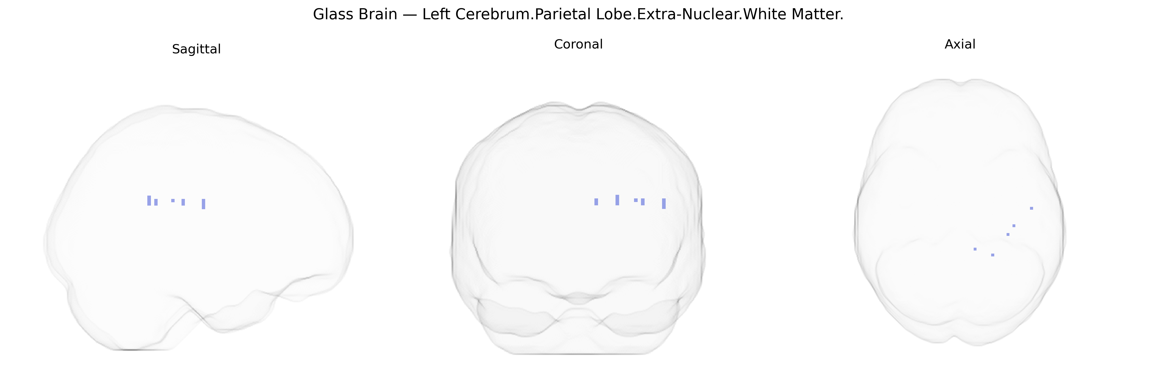 Triplanar Ghost Brain