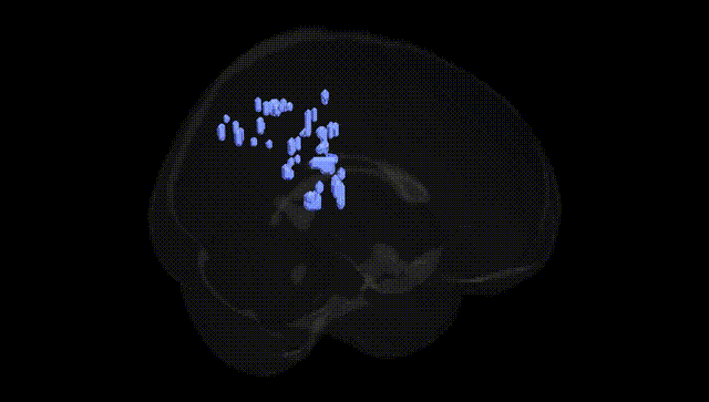 Full Brain Black