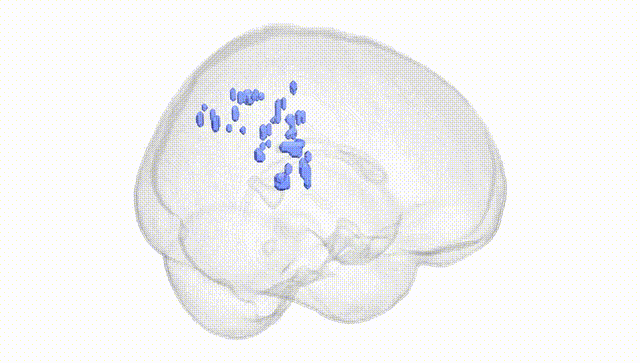 Full Brain White