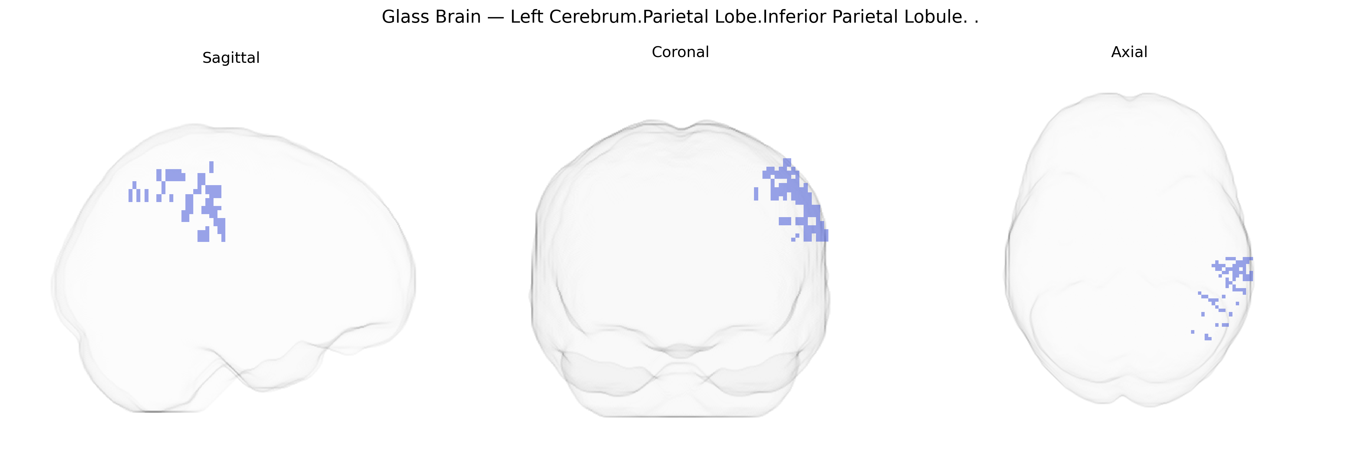 Triplanar Ghost Brain
