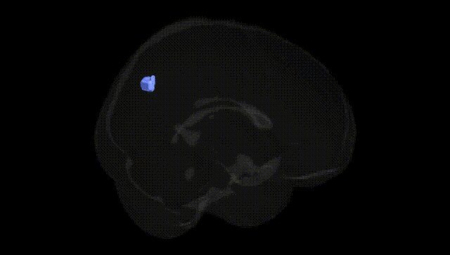 Full Brain Black