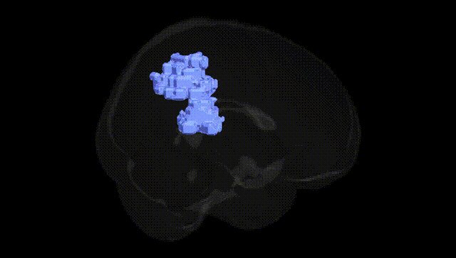 Full Brain Black