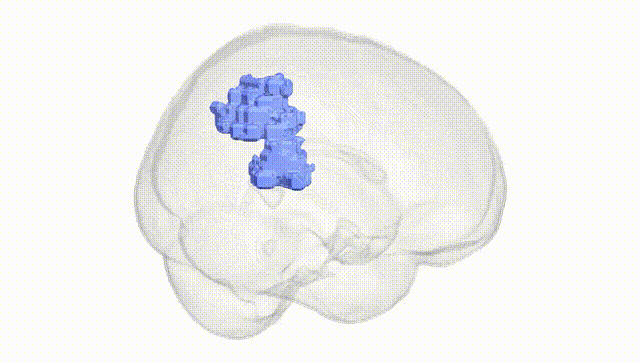 Full Brain White