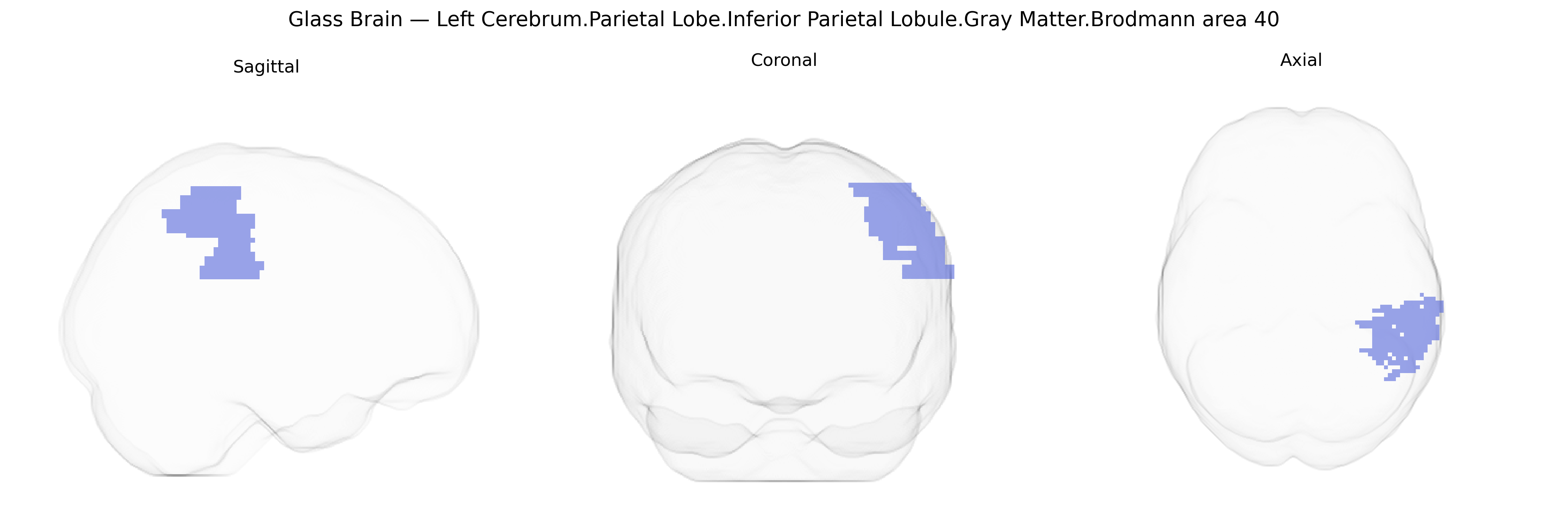 Triplanar Ghost Brain