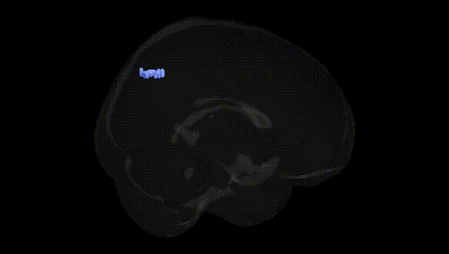 Full Brain Black
