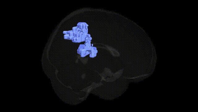 Full Brain Black