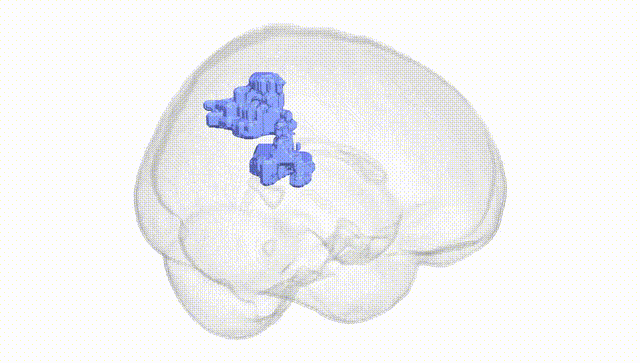 Full Brain White