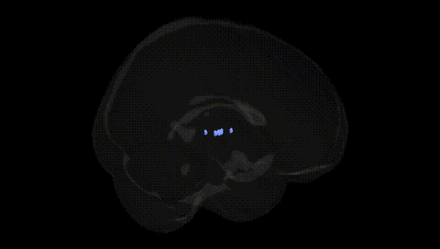 Full Brain Black