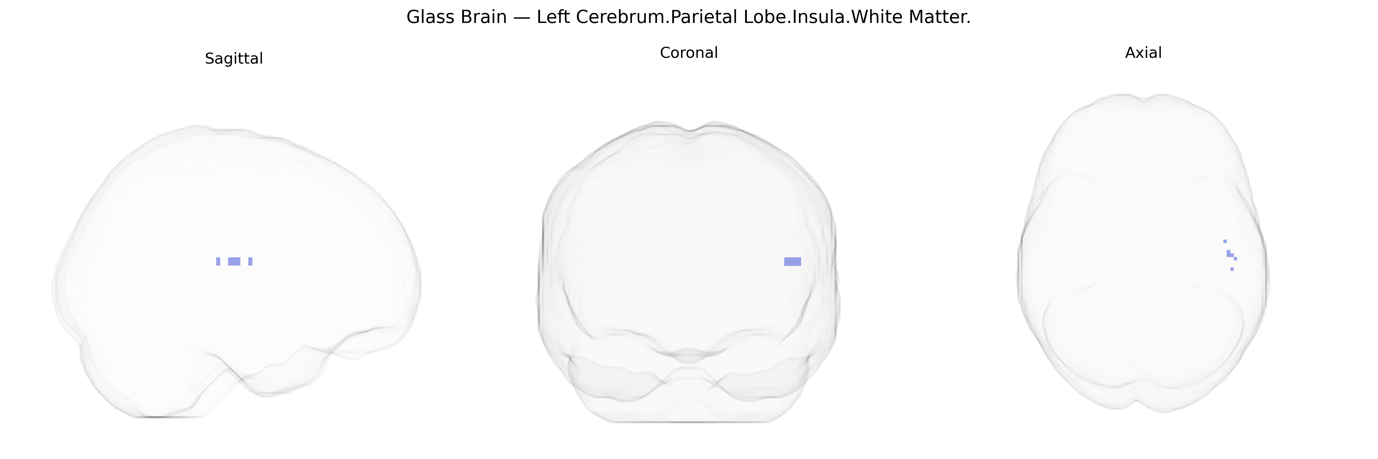 Triplanar Ghost Brain