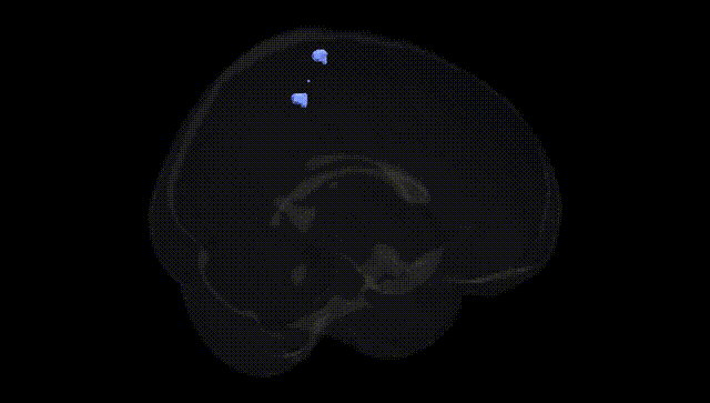 Full Brain Black