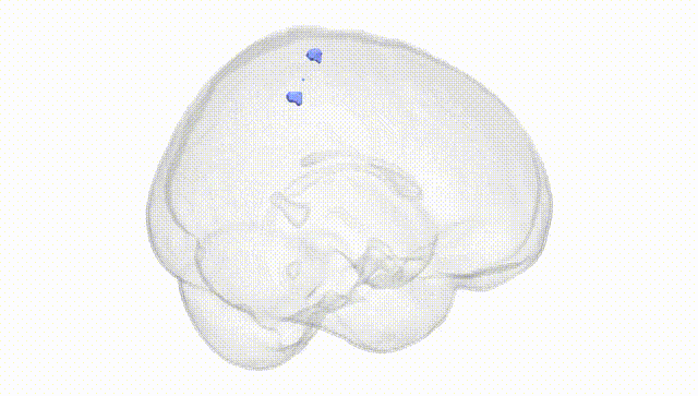 Full Brain White