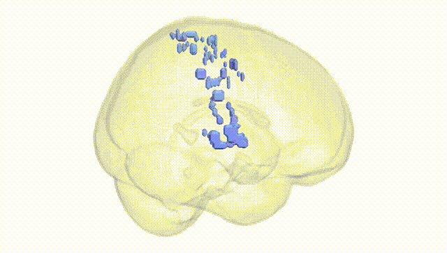 Full Brain White