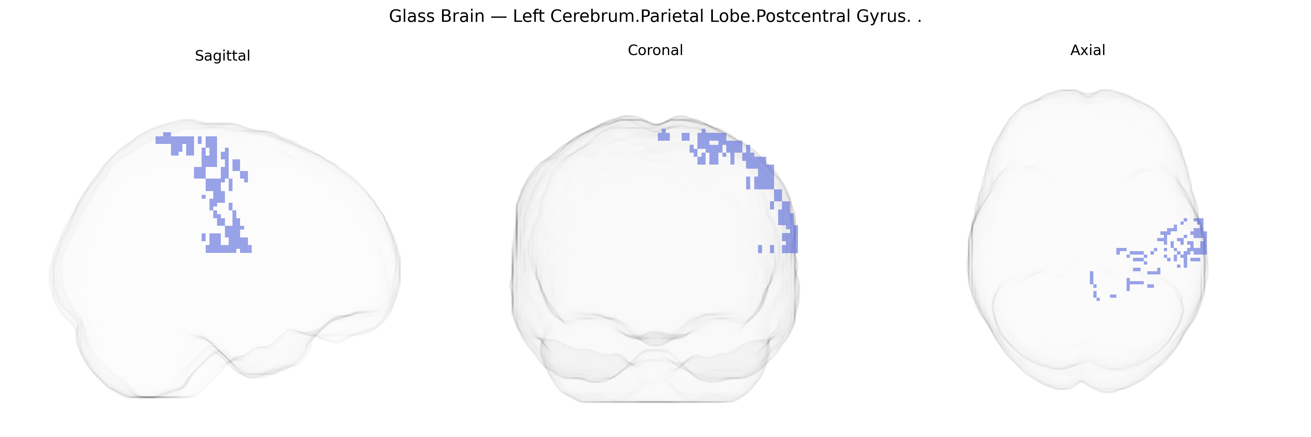 Triplanar Ghost Brain