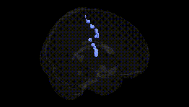 Full Brain Black