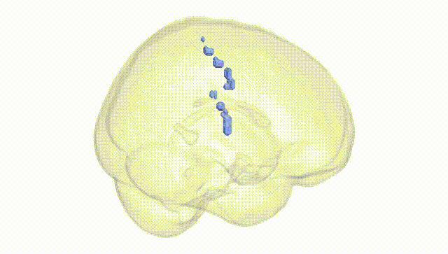 Full Brain White