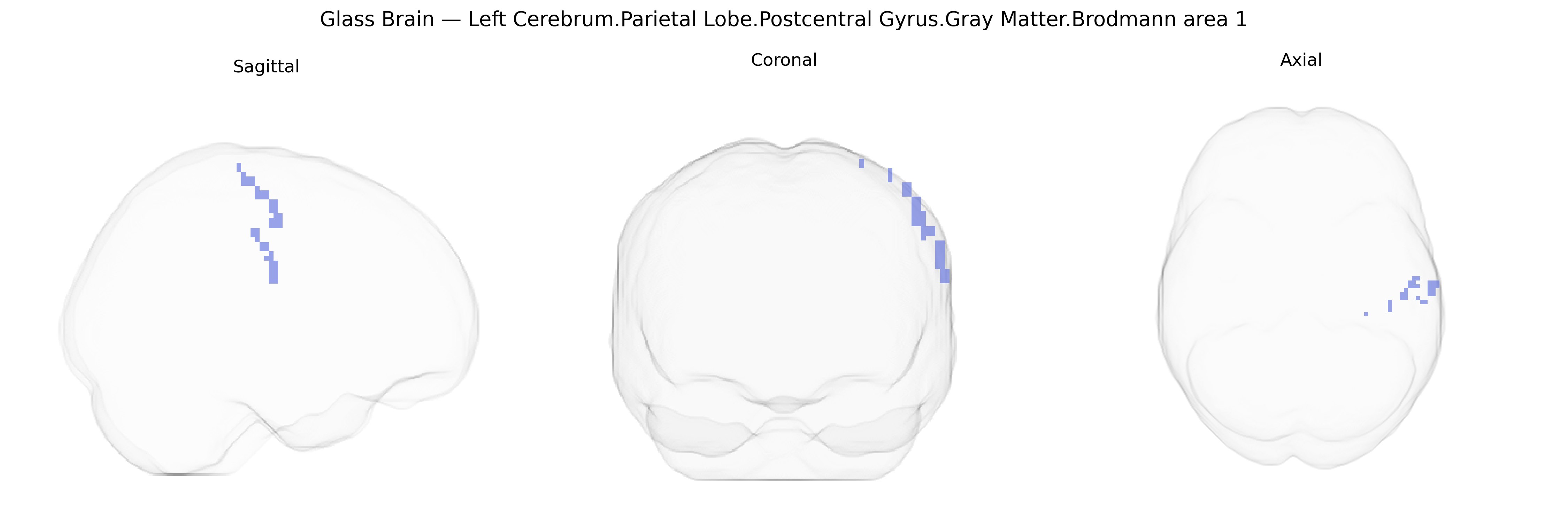 Triplanar Ghost Brain