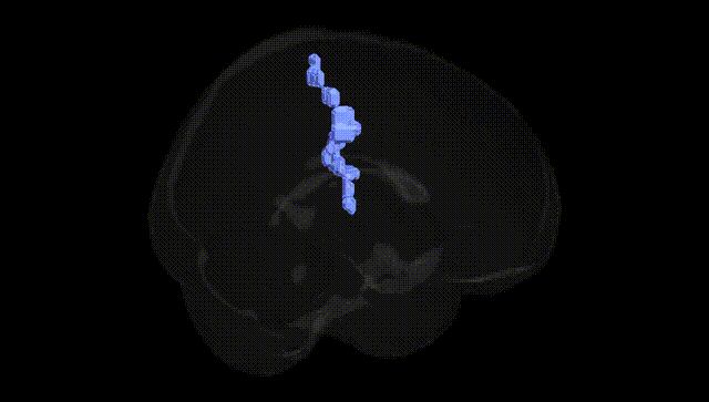 Full Brain Black