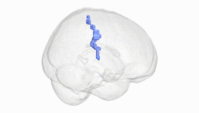 Full Brain White