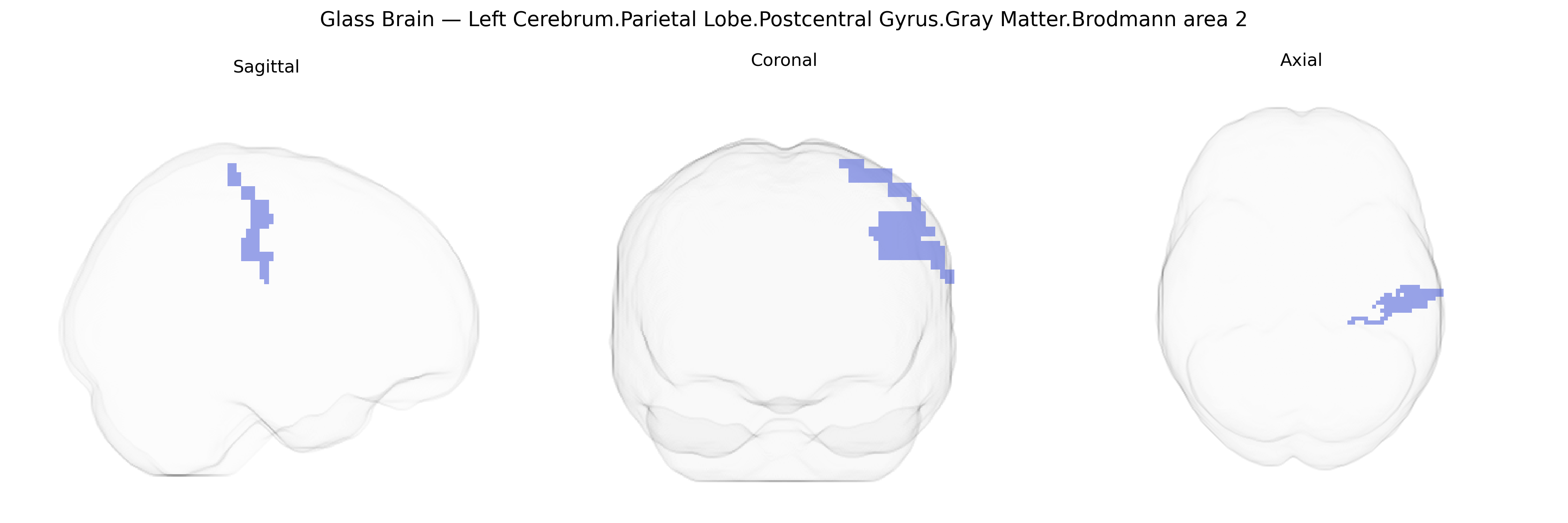 Triplanar Ghost Brain