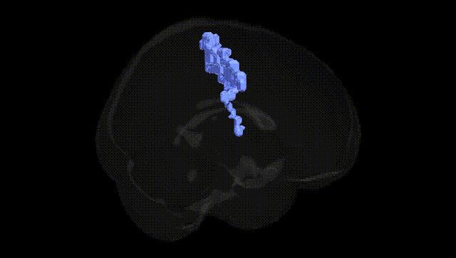 Full Brain Black