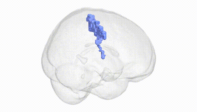 Full Brain White