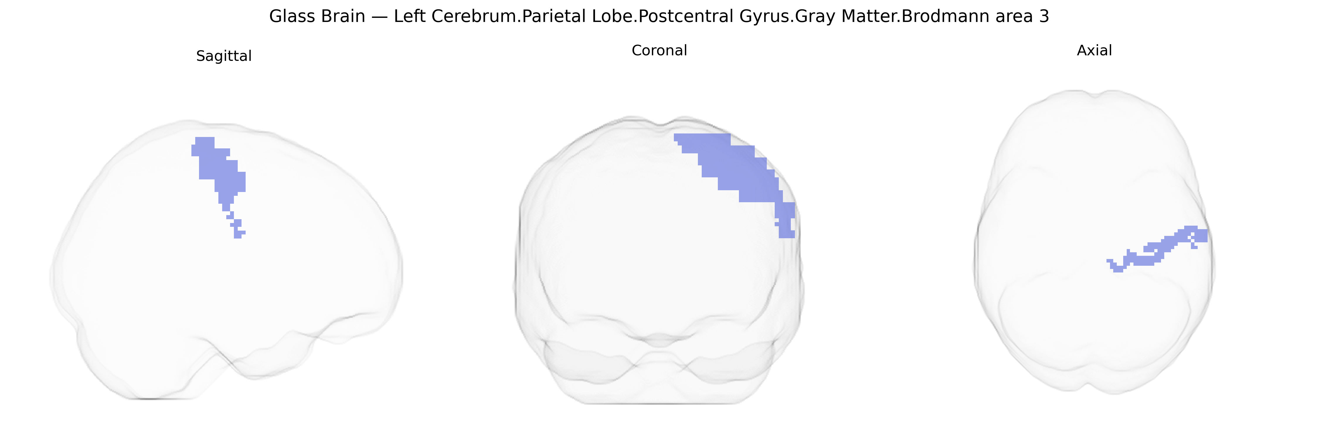 Triplanar Ghost Brain