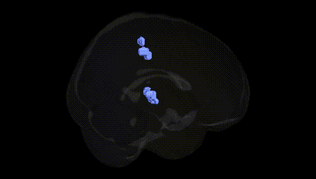 Full Brain Black