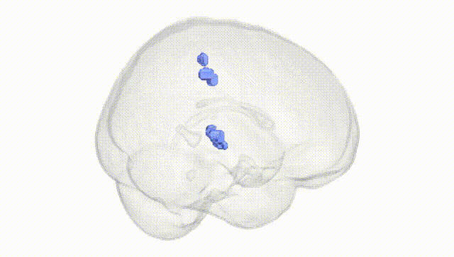 Full Brain White