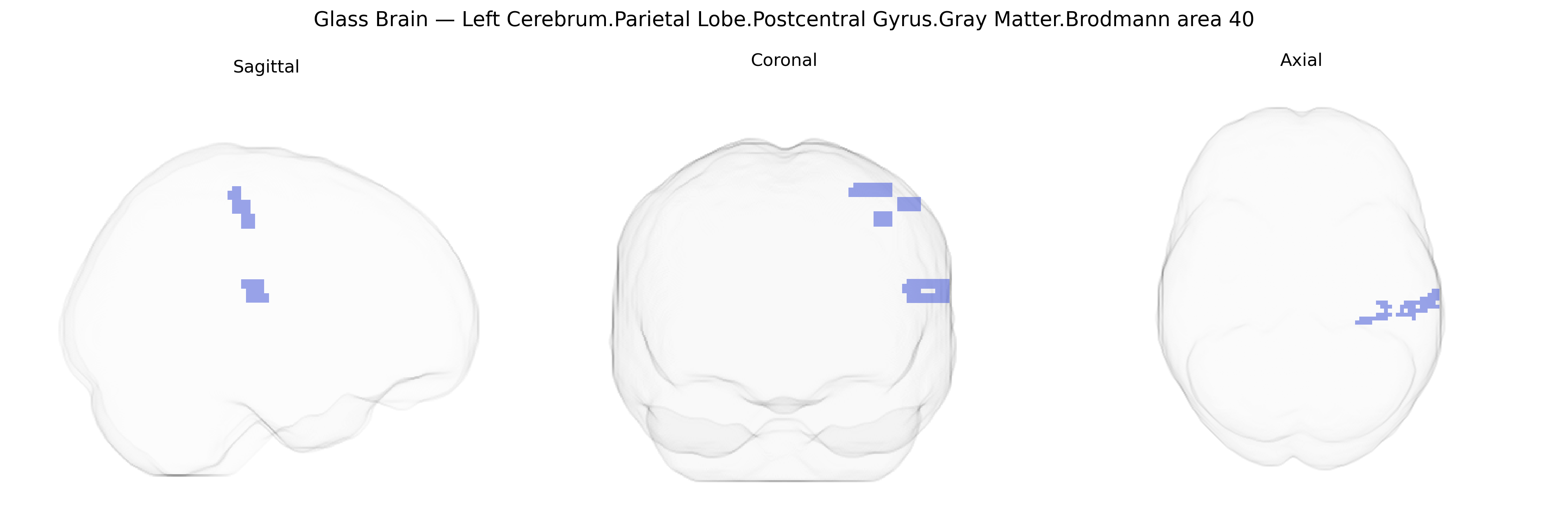 Triplanar Ghost Brain