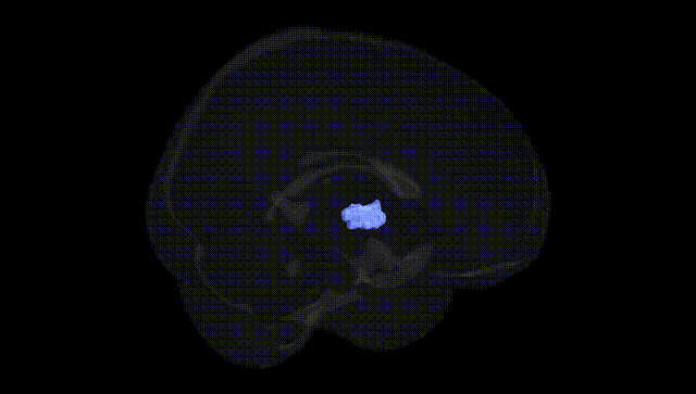 Full Brain Black