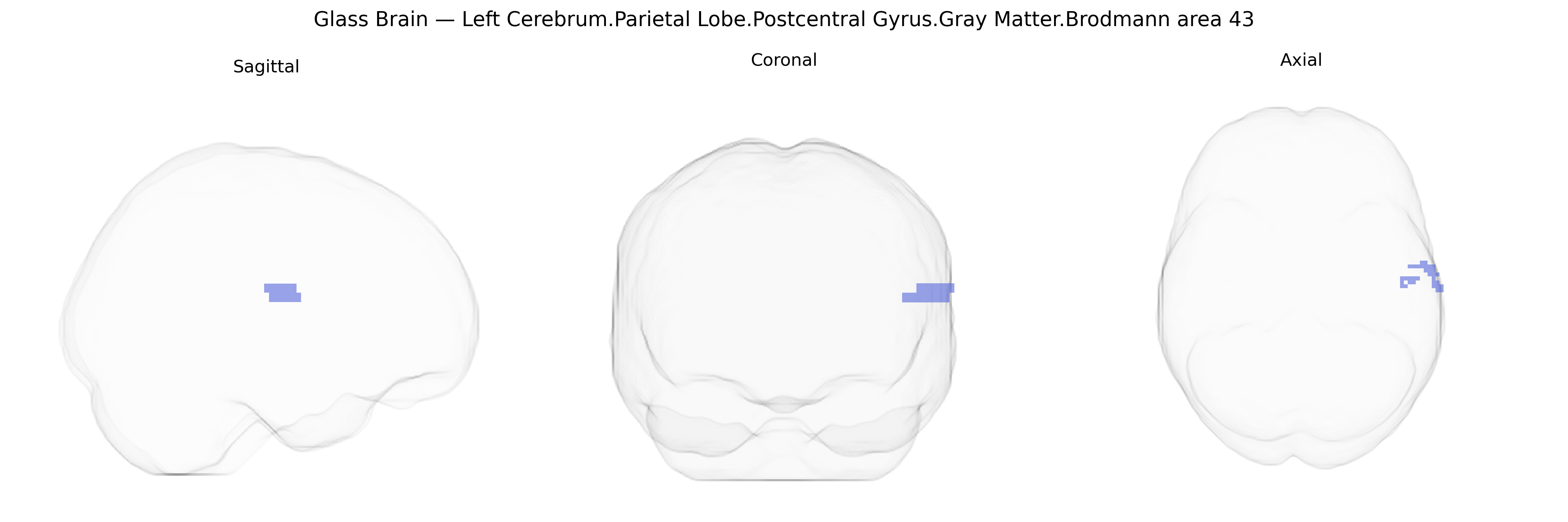 Triplanar Ghost Brain
