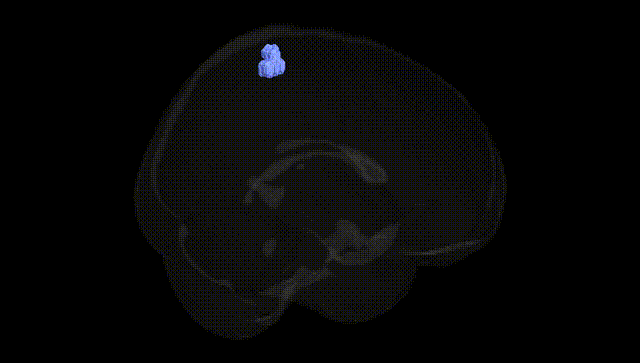 Full Brain Black