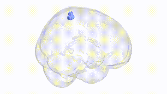 Full Brain White