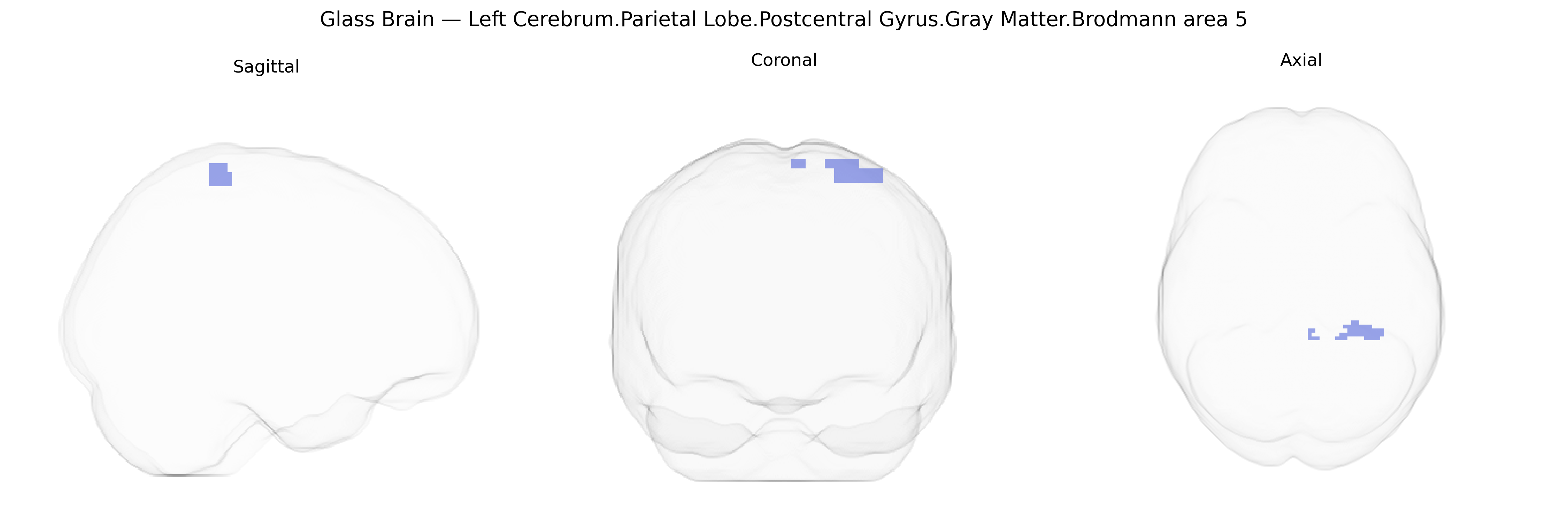 Triplanar Ghost Brain